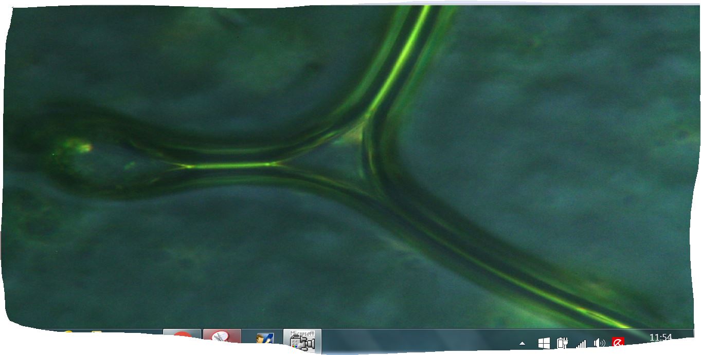vorticella?
